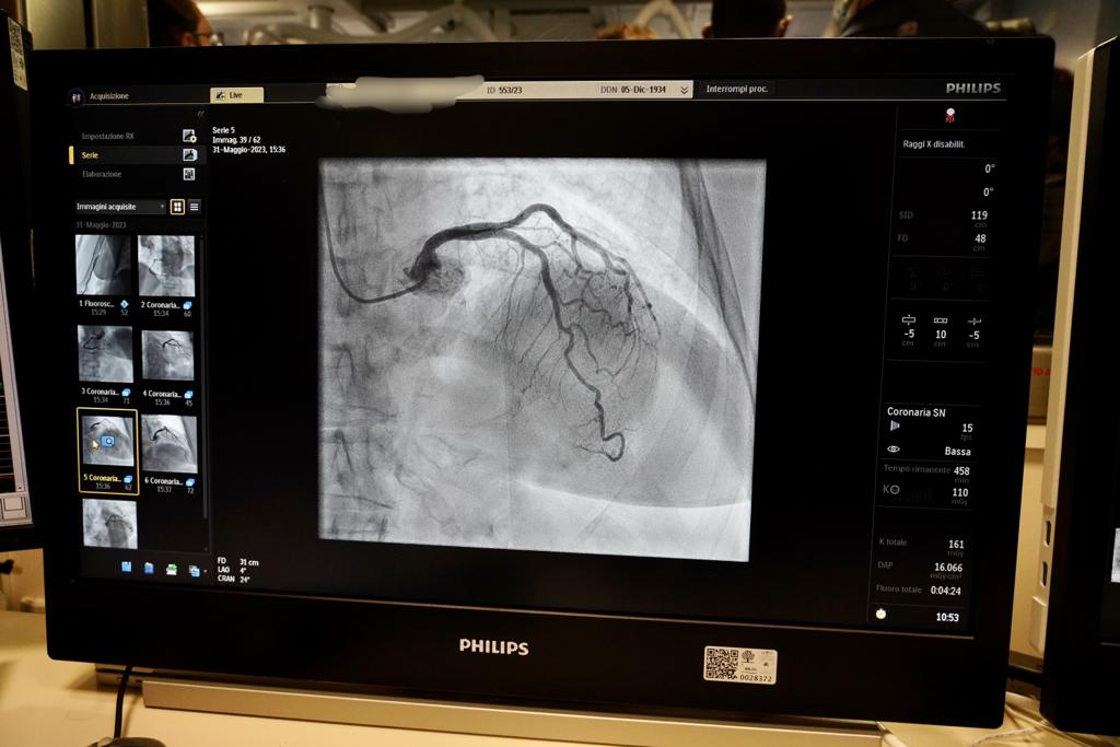 Galleria Cardiologia hi tech all’Ospedale Di Venere: installati due nuovi angiografi con tecnologia digitale - Diapositiva 12 di 12